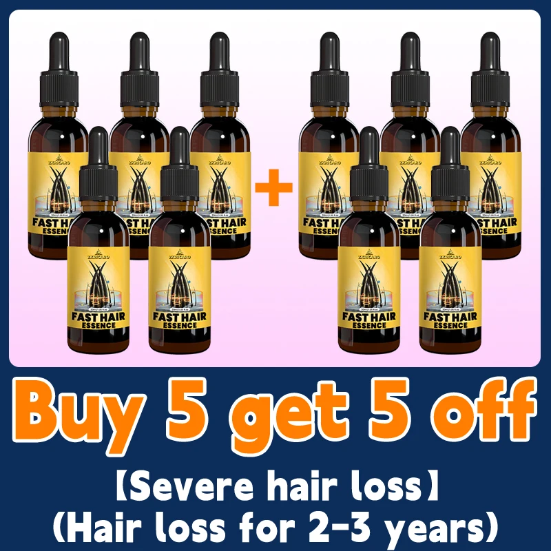 Don’t worry about all kinds of hair loss, gentle essential oil care can help you regain "super hair" - Image 10