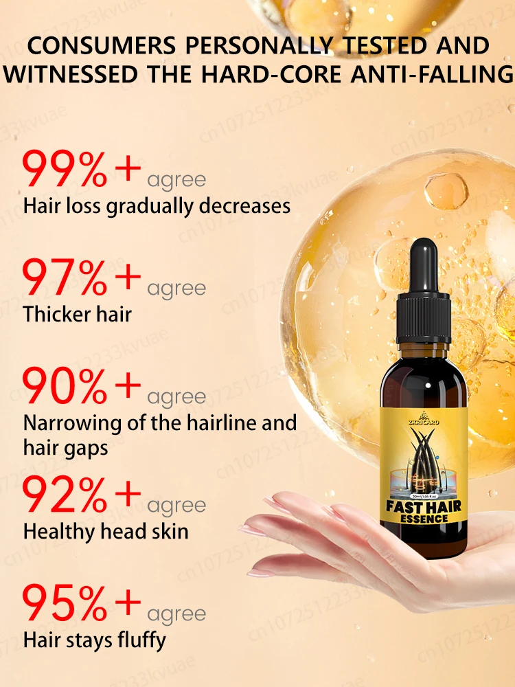 Don’t worry about all kinds of hair loss, gentle essential oil care can help you regain "super hair" - Image 6