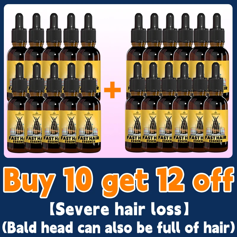 Don’t worry about all kinds of hair loss, gentle essential oil care can help you regain "super hair" - Image 11
