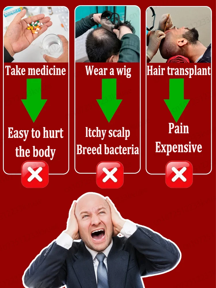 Don’t worry about all kinds of hair loss, gentle essential oil care can help you regain "super hair" - Image 4