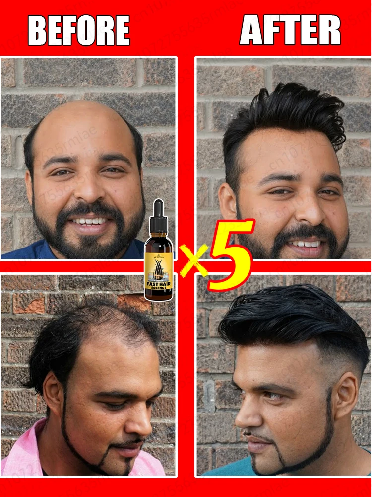 Don’t worry about all kinds of hair loss, gentle essential oil care can help you regain "super hair" - Image 2