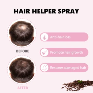 Hair Care Spray Nourishes Hair Scalp Moisturizes And Softens Hair, Repair Damage Strengthen Hair Follicles Reducing Hair Loss