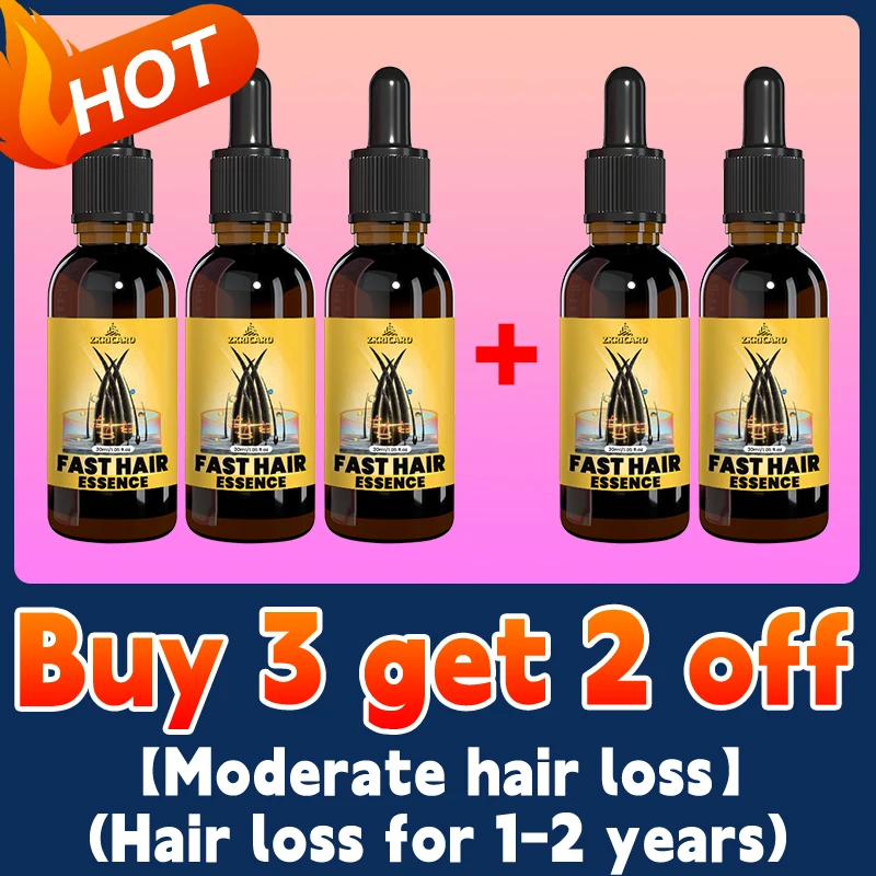 Don’t worry about all kinds of hair loss, gentle essential oil care can help you regain "super hair" - Image 9
