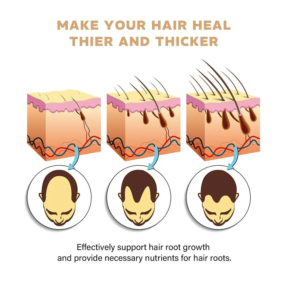 Hair Loss Treatment Shampoo Promotes Growth, Strengthens Roots, Repairs Scalp, Anti-Thinning & Moisturizing Thickening Hair Care - Image 5